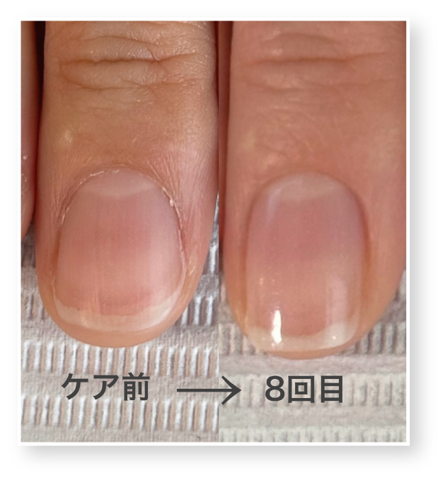 西院ネイルサロン｜美爪育成ネイルケアならnaicy｜ネイジー