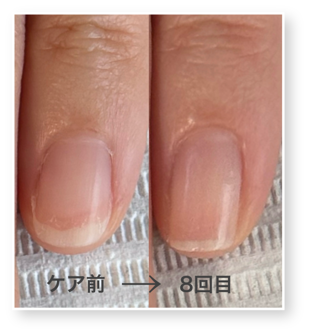 西院ネイルサロン｜美爪育成ネイルケアならnaicy｜ネイジー