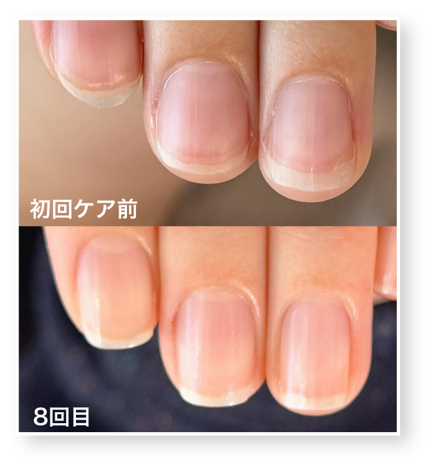 西院ネイルサロン｜美爪育成ネイルケアならnaicy｜ネイジー